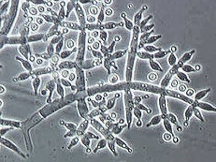 Fungos do bem: Trichoderma para controlar doenças na agricultura